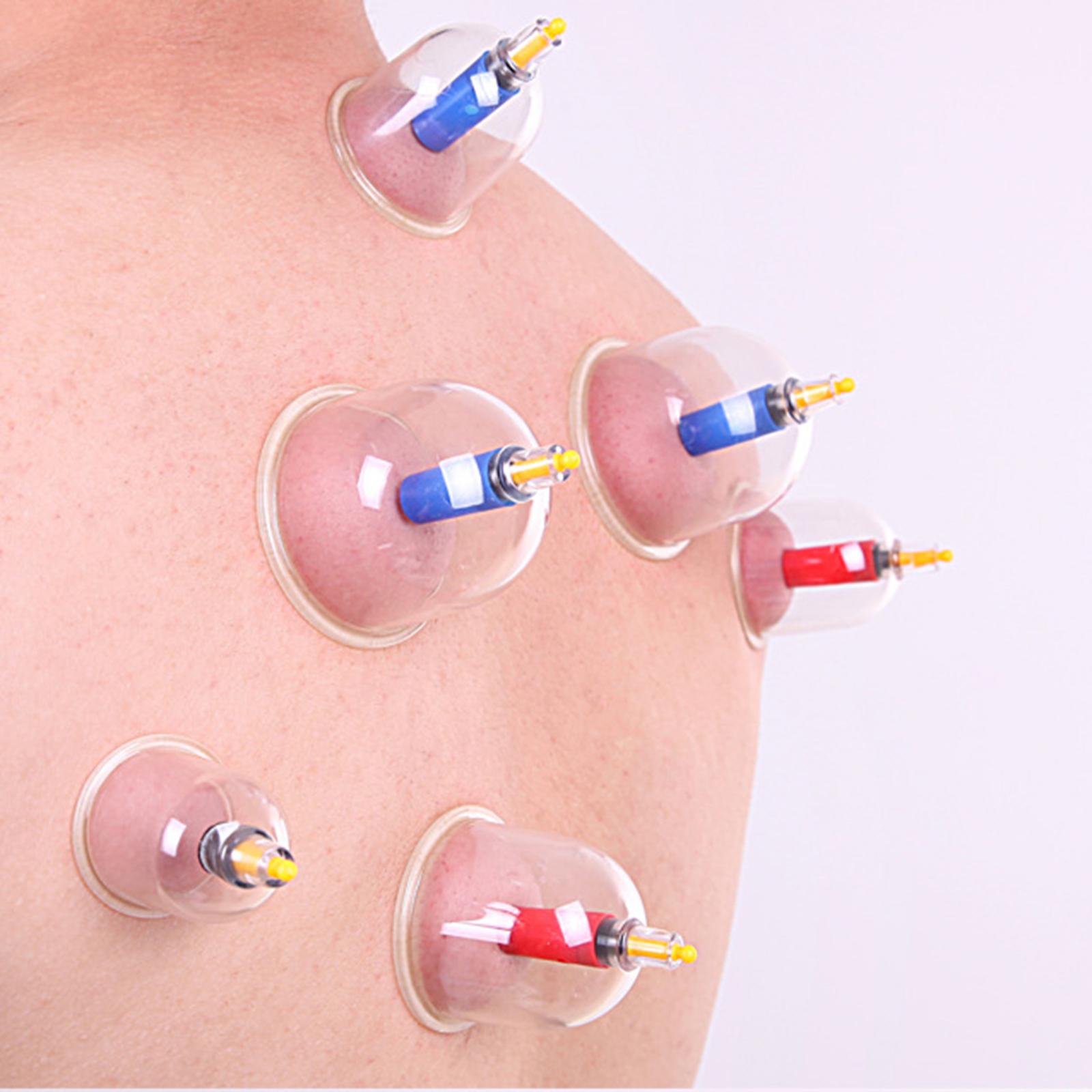 Bộ 24 Ly giác hơi toàn thân nhiều kích cỡ