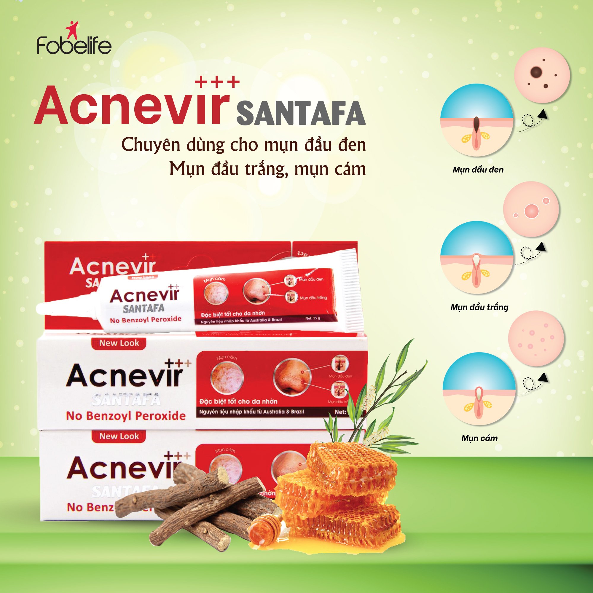 Kem Hỗ Trợ Giảm Mụn Đầu Đen Cho Da Nhờn Acnevir đỏ