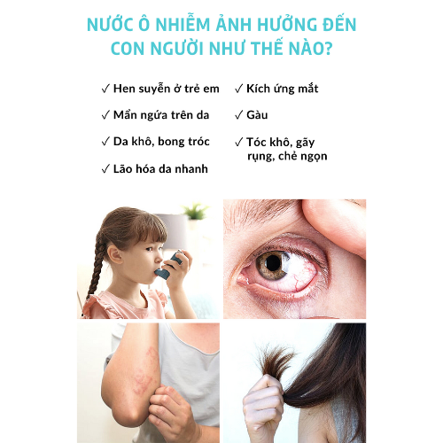 Màng lọc đầu vòi sen Daily Aqua (5 miếng) - Lọc bụi bẩn, vi khuẩn