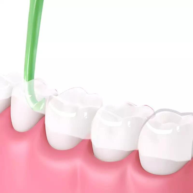Dụng cụ tháo máng chỉnh nha trong suốt , tháo niềng