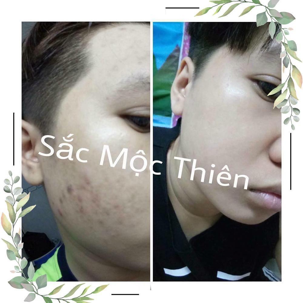 Serum Tinh Chất Giúp Tái Tạo Da Sắc Mộc Thiên 30ml