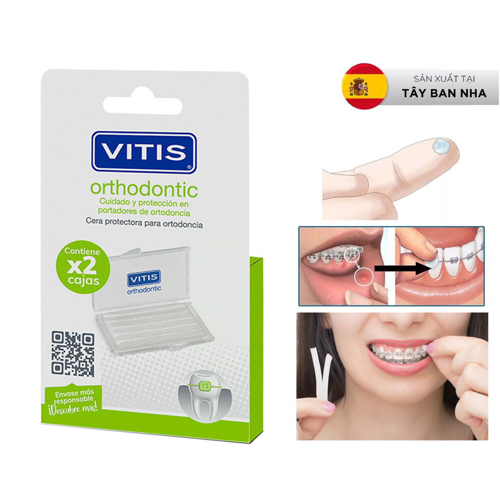Hình ảnh Sáp nha khoa giảm đau khi niềng răng, chỉnh nha - Vitis Orthodontic Wax (Vỉ 2 hộp)