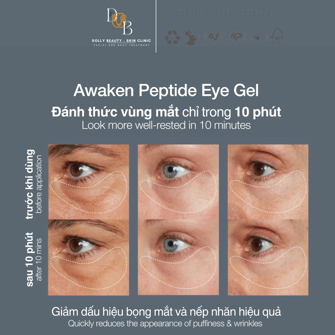 [DERMALOGICA] Kem dưỡng mắt dạng gel giúp mắt khoẻ AWAKEN PEPTIDE EYE GEL đánh thức vùng mắt từ sâu bên trong