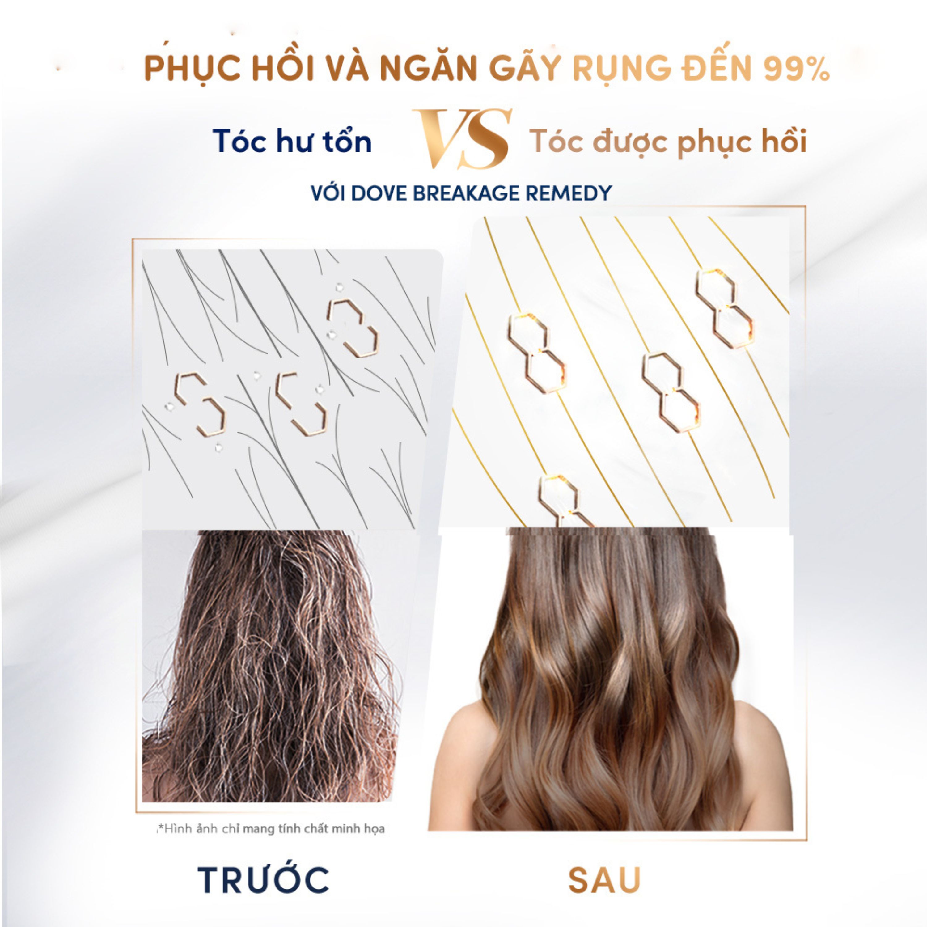 Combo Dầu gội và Kem Xả Serum 2 trong 1 Dove Breakage Remedy Phục hồi và Ngăn gãy rụng 380ml, 230 ml