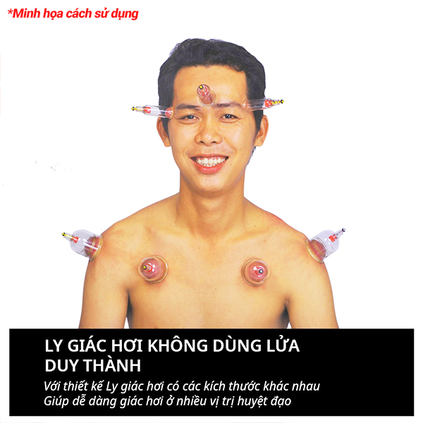 Bộ giác hơi 12 ly giác không dùng lửa Duy Thành YGH0412 hỗ trợ thuyên giảm nhức mỏi được sở y tế cấp phép lưu hành | Fireless cupping therapy 12 cups