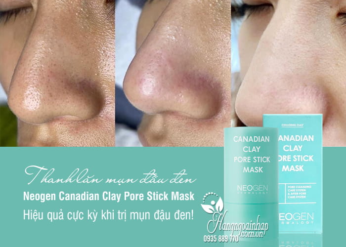 Thanh Lăn Đất Sét Giảm Mụn Đầu Đen Neogen Dermalogy Canadian Clay Pore Stick