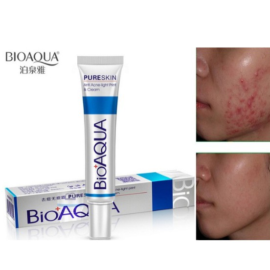 Kem Hỗ Trợ Giảm Mụn Trứng Cá , Hết Sẹo, Sưng Đỏ BIOAQUA Pure Skin