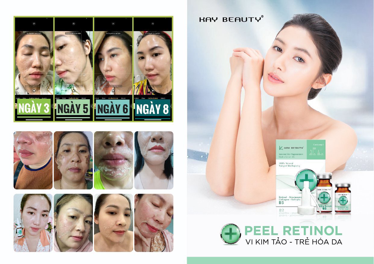 PEEL RETINOL VI KIM TẢO thay mới làn da - không sưng - không đỏ - SEAWEED SKIN REGENERATION HYDRA SERUM B5 KAY BEAUTY - Hộp quà tặng cho chị em