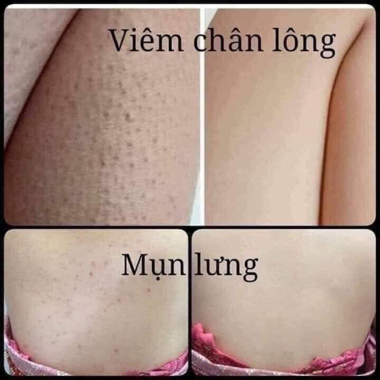 [Hàng cao cấp] - Tắm Trắng Thuốc Bắc Huyền Phi