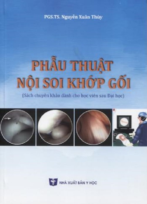 Phẫu Thuật Nội Soi Khớp Gối