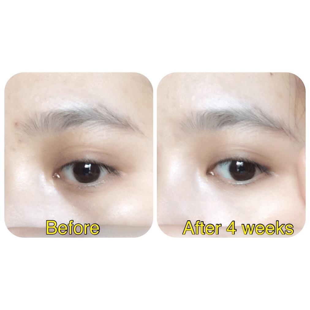 Kem mắt chống lão hoá mờ thâm làm sáng da vùng mắt Meishoku Whitening Eye Cream 30g Nhật Bản.