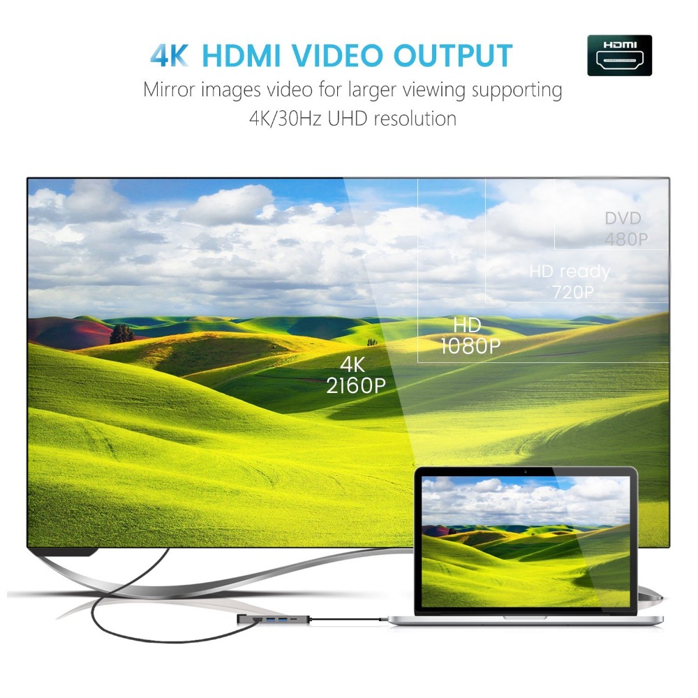5 in 1 Type C Hub Hdmi Rj45 Lan Adapter for Macbook Pro Thunderbolt 3, USB C to Gigabit Ethernet Adapter USB-C Charger Port