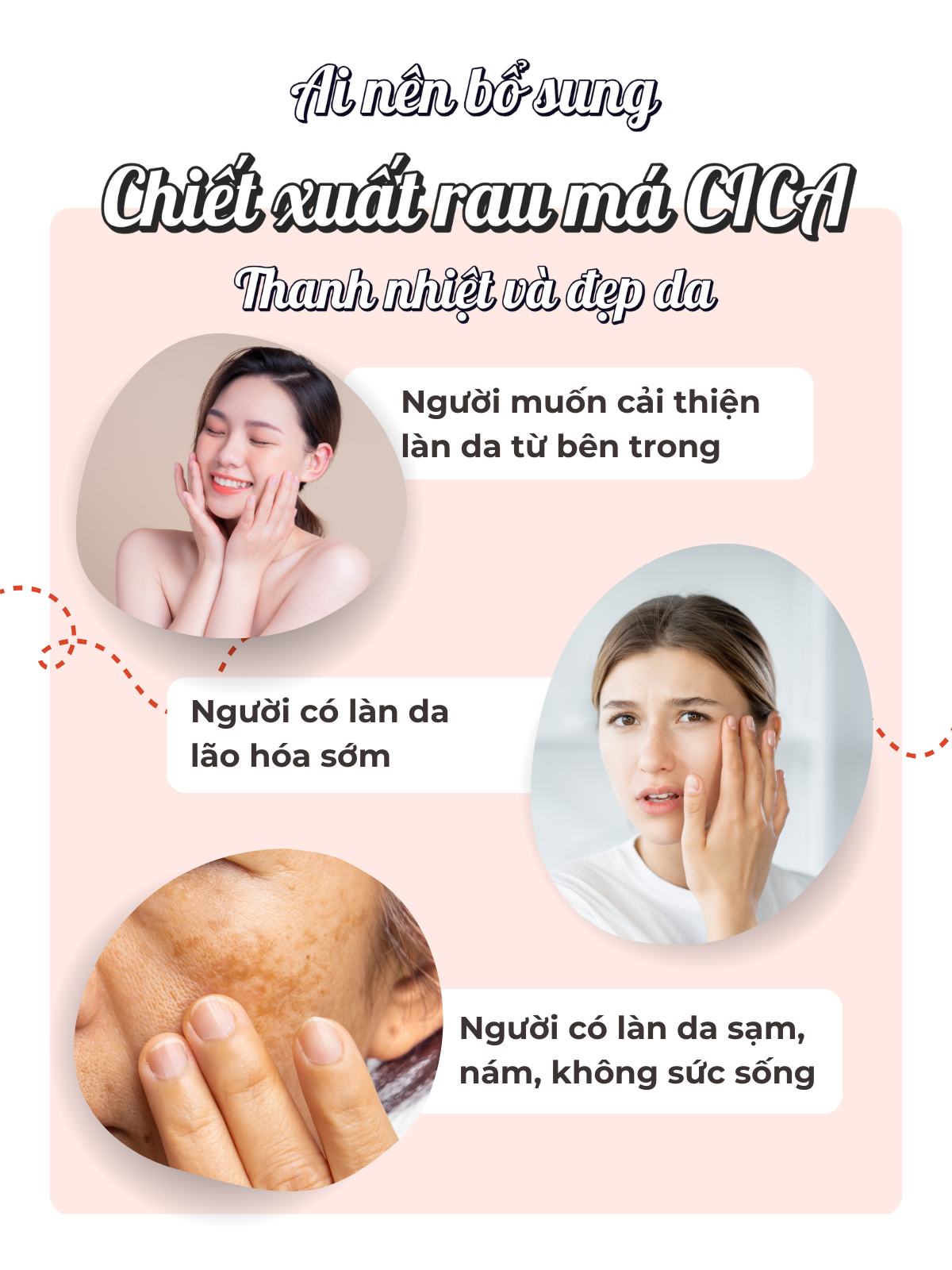 Viên Uống Chiết Xuất Rau Má CICA Hỗ Trợ Thanh Nhiệt Và Đẹp Da Seedcoms Nhật Bản