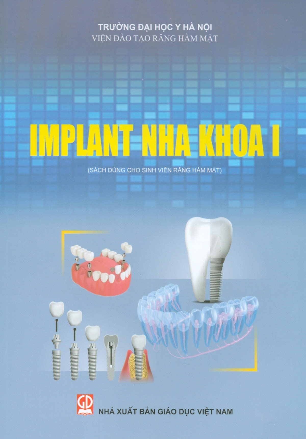 Implant nha khoa I - Sách mới 2021