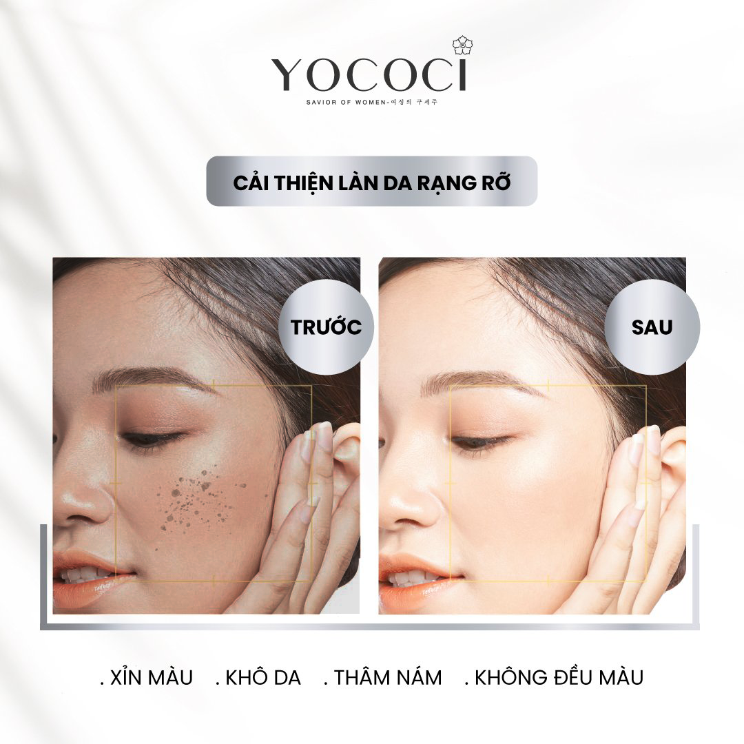 Hình ảnh Serum dưỡng trắng da mặt Yococi giúp phục hồi sáng da, căng bóng ngăn ngừa lão hóa se khít lỗ chân lông White Perfect Face Serum 20ml