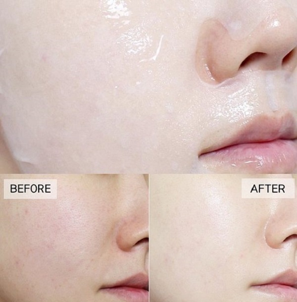 Combo 10 Mặt nạ dưỡng da trắng sáng và làm đều màu da BNBG Vita Genic Whitening Jelly Mask 30ml x 10