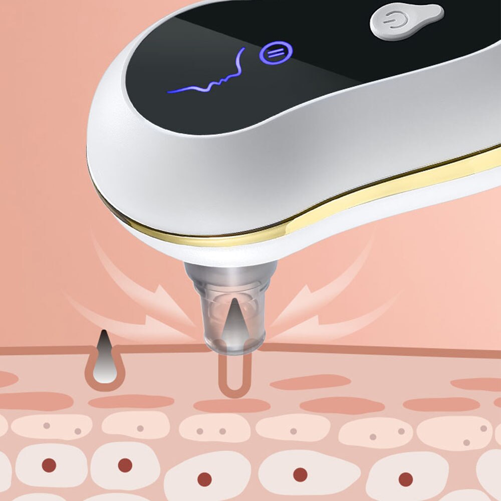 Máy hút mụn cầm tay Vacuum Suction Black Dots Clean Skin Tools