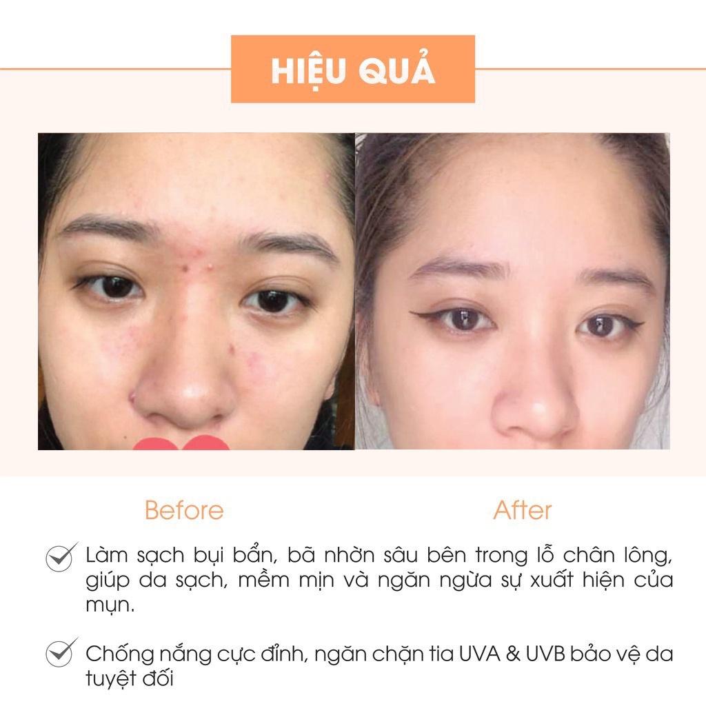 Kem Face Pháp Acosmetics - Kem dưỡng trắng da mặt - 20g - Giúp ngăn ngừa mụn, thâm nám tàn nhang,Hiệu quả chỉ sau 1 tuần