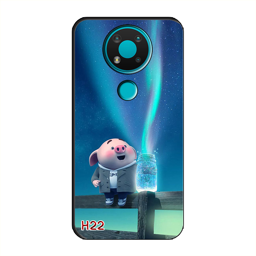 Ốp Dẻo Dành Cho NOKIA 3.4