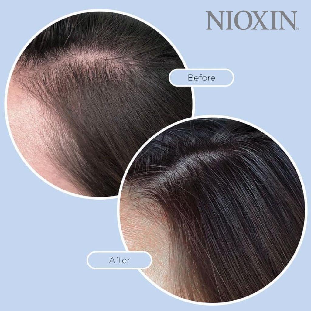 Dầu Hấp Tóc Nioxin 3D Bảo Vệ Tóc Và Da Đầu, Giúp Tóc Vào Nếp Mềm Mượt Intensive Deep Protect Density Mask 150ml/500ml