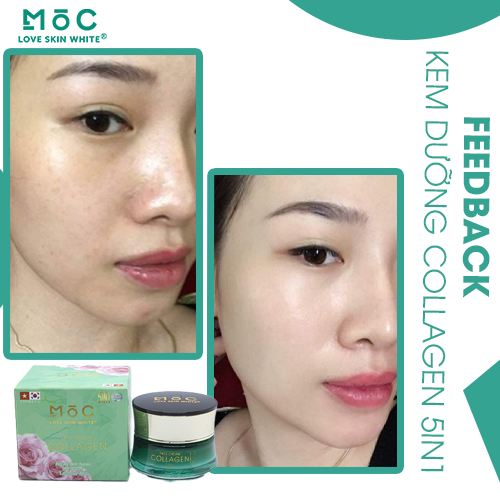 Kem Face Collagen 5 in 1 Mộc 45g