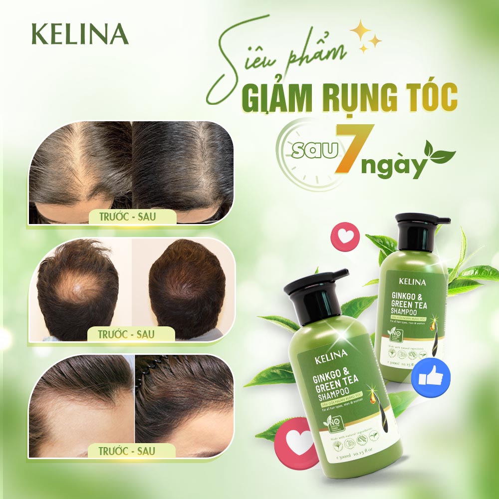 Dầu Gội Thảo Dược Kích Mọc Tóc, Ngăn Ngừa Gàu Ngứa Và Bết Tóc Kelina 300ml