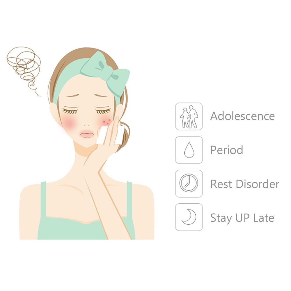 36 miếng dán mụn tàng hình
