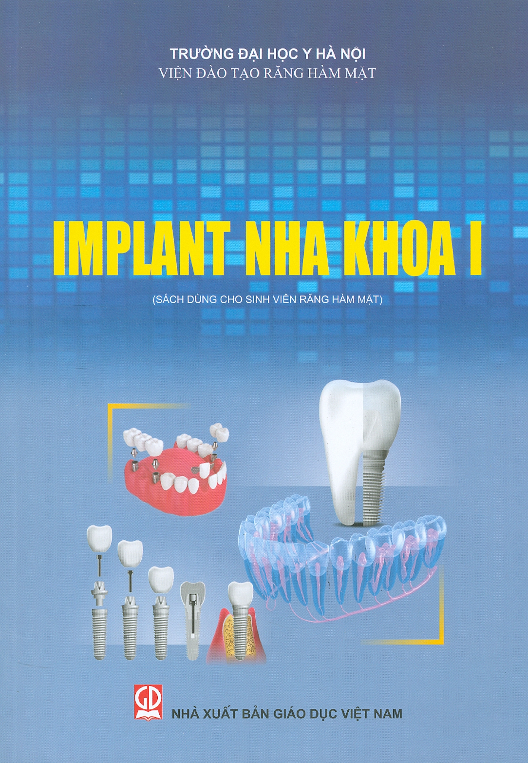 Implant Nha Khoa I (Sách dùng cho sinh viên Răng Hàm Mặt) (Tái bản lần thứ nhất - năm 2023)
