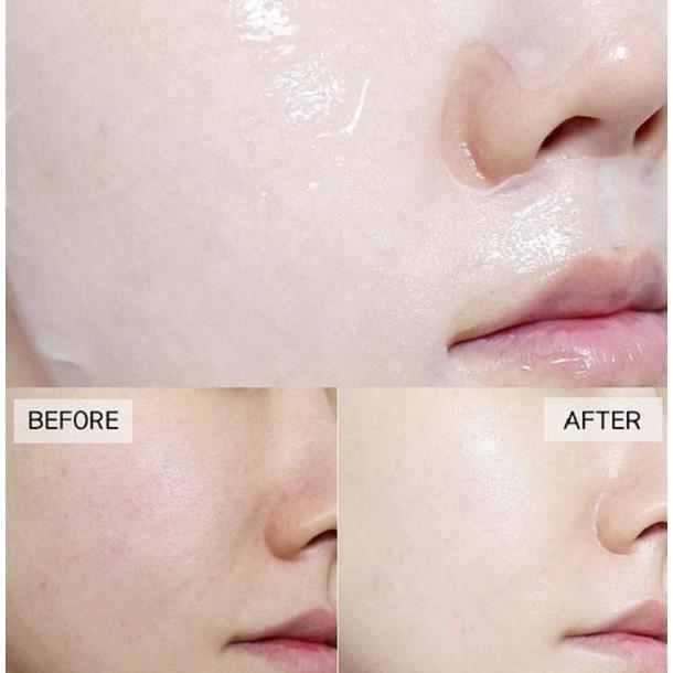 Combo 4 mặt nạ BNBG Vita Genic Jelly Mask 30ml x 4