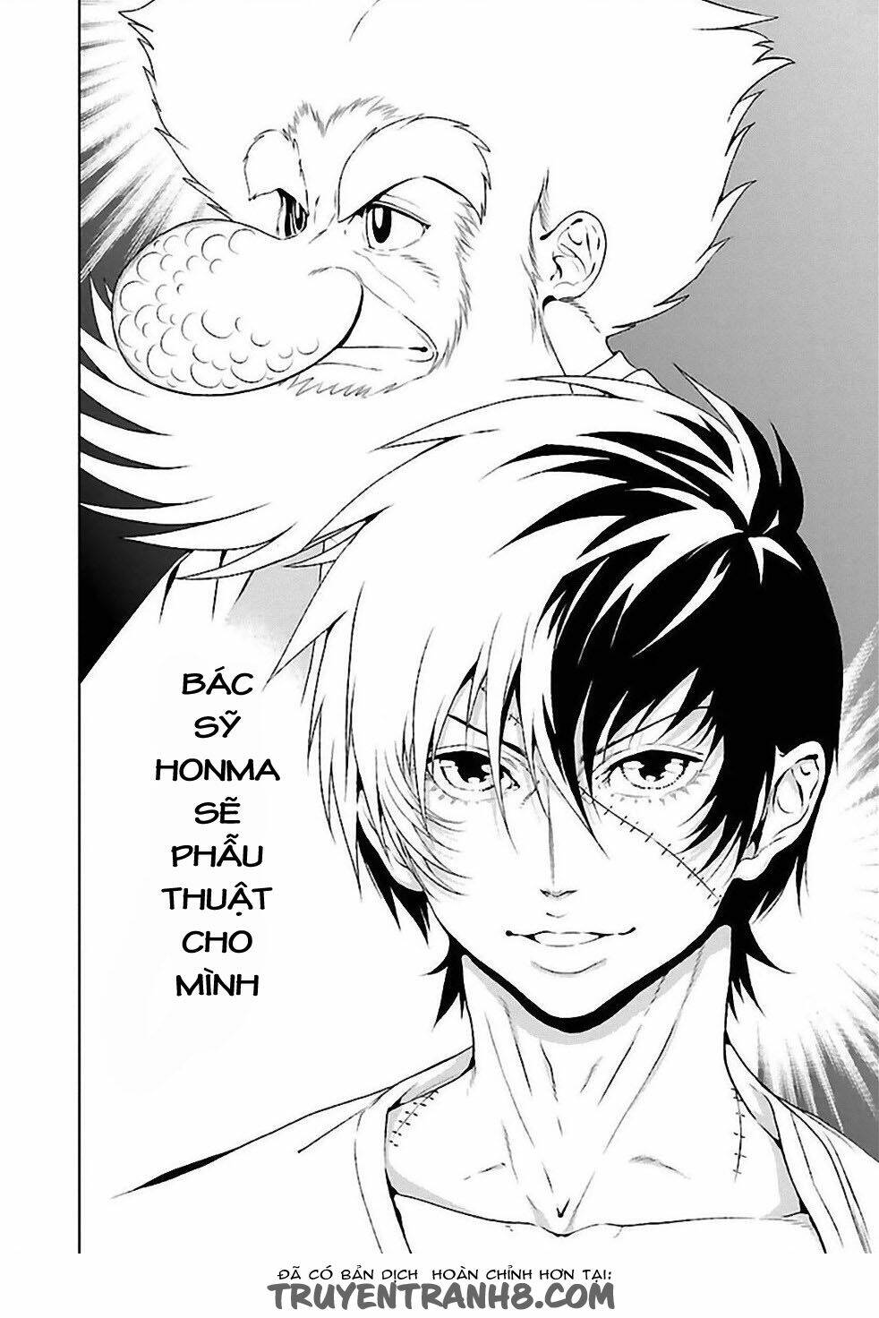 thời niên thiếu bác sĩ quái dị chapter 32 4