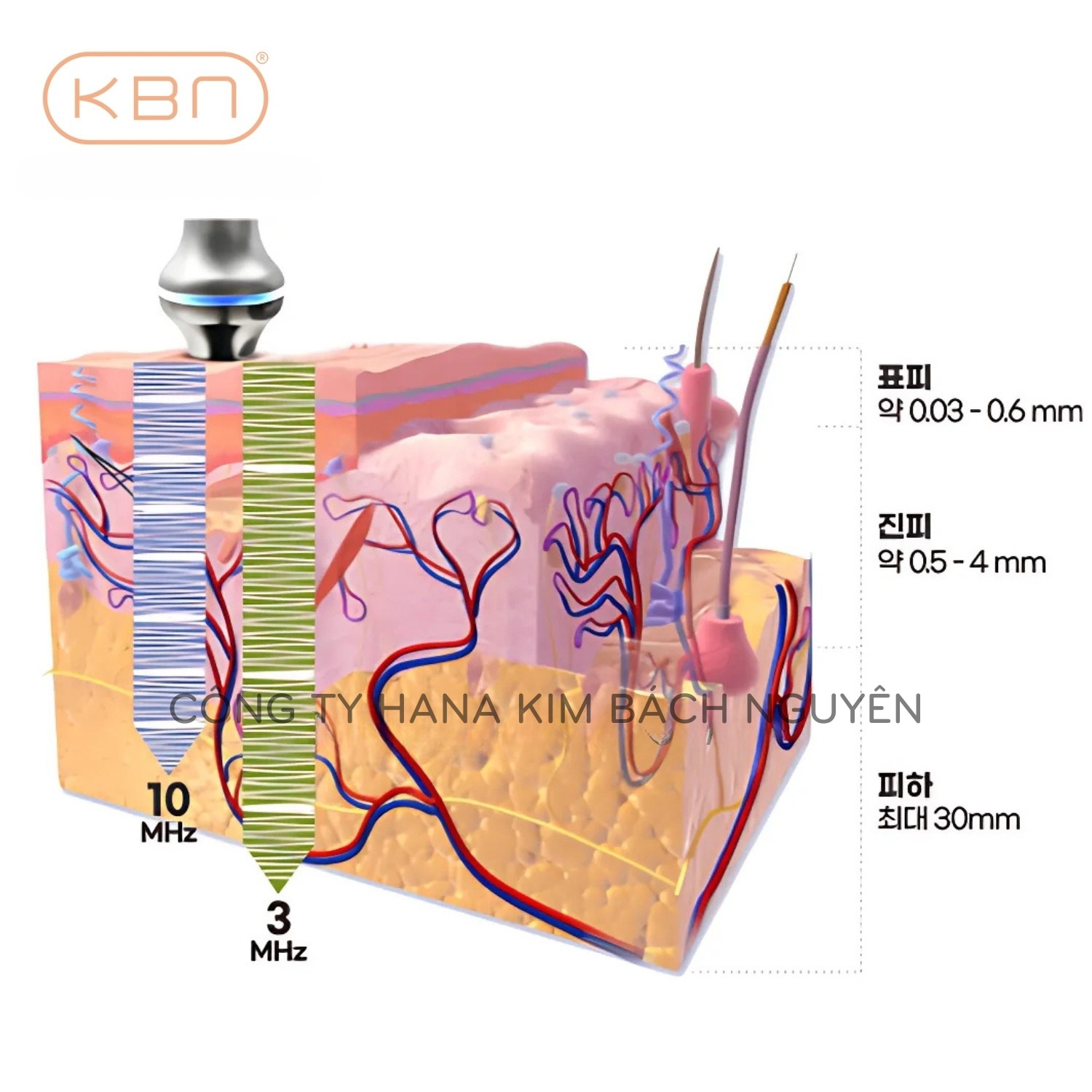 Máy Nâng Cơ Lipro Hàn Quốc Xóa Nhăn, Trẻ Hóa Da