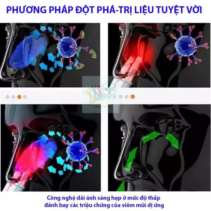 Máy Hỗ Trợ Viêm Xoang, Viêm Mũi Dị Ứng – Hiệu Quả Nhanh, Loại Tốt Nên Dùng