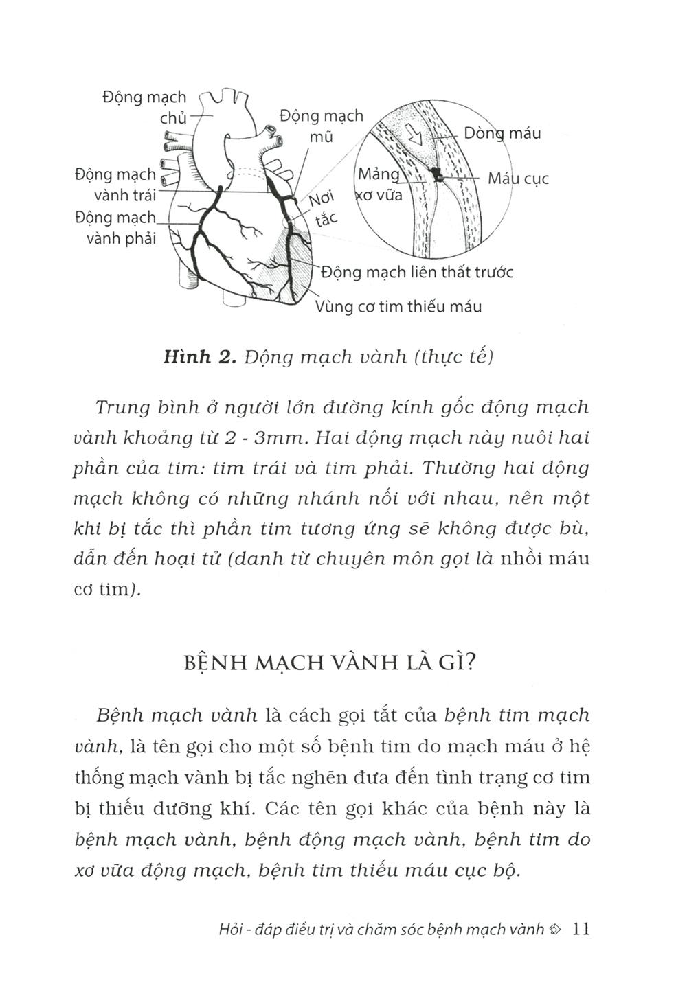 Hỏi - Đáp Điều Trị Và Chăm Sóc Mạch Vành
