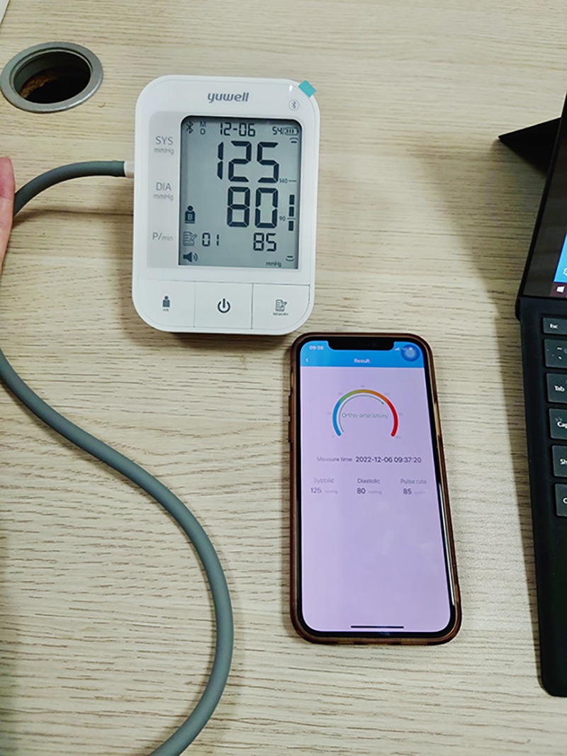 Máy Đo Huyết Áp Pin Sạc Yuwell YE670CR - Nhập khẩu chính hãng