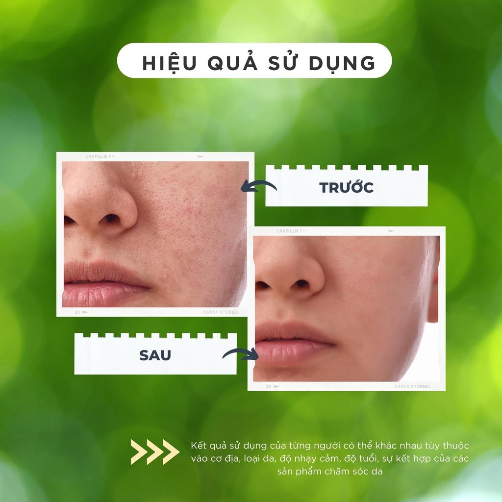 Kem dưỡng trắng giảm mờ nám, tàn nhang, dưỡng da trắng hồng đều màu CHAMIS