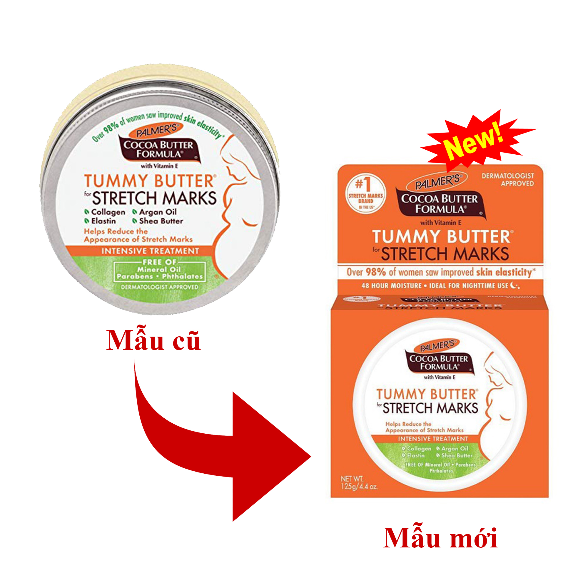 Bộ 2 ngăn ngừa rạn da từ tháng thứ 5 của thai kì Palmer's