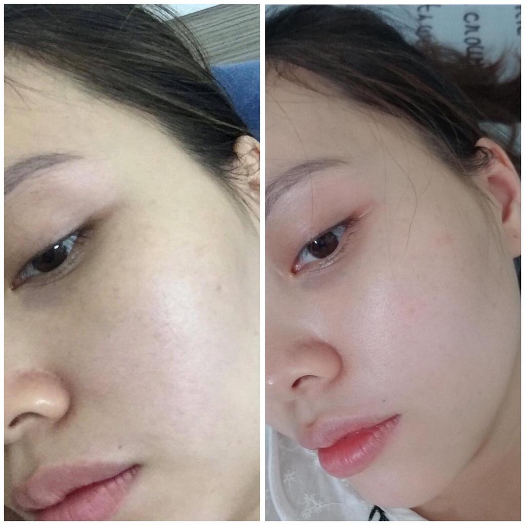 Serum dưỡng sáng da mụn nhạy cảm The Beauty of Jones