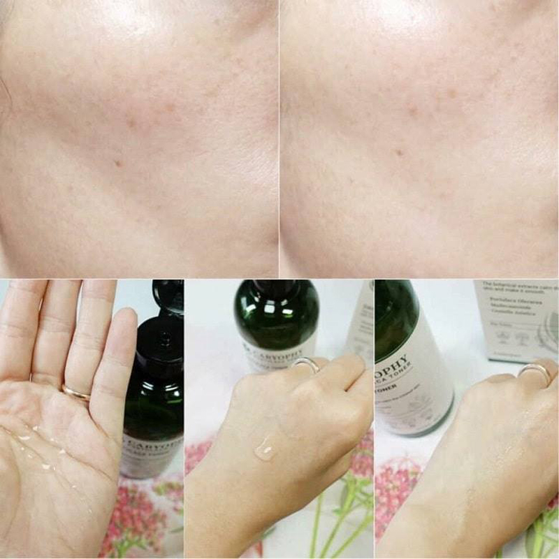 Bộ  sản phẩm da mụn Caryophy (Sữa rửa mặt -Toner -Serum) + Tặng mặt nạ Some By Mi