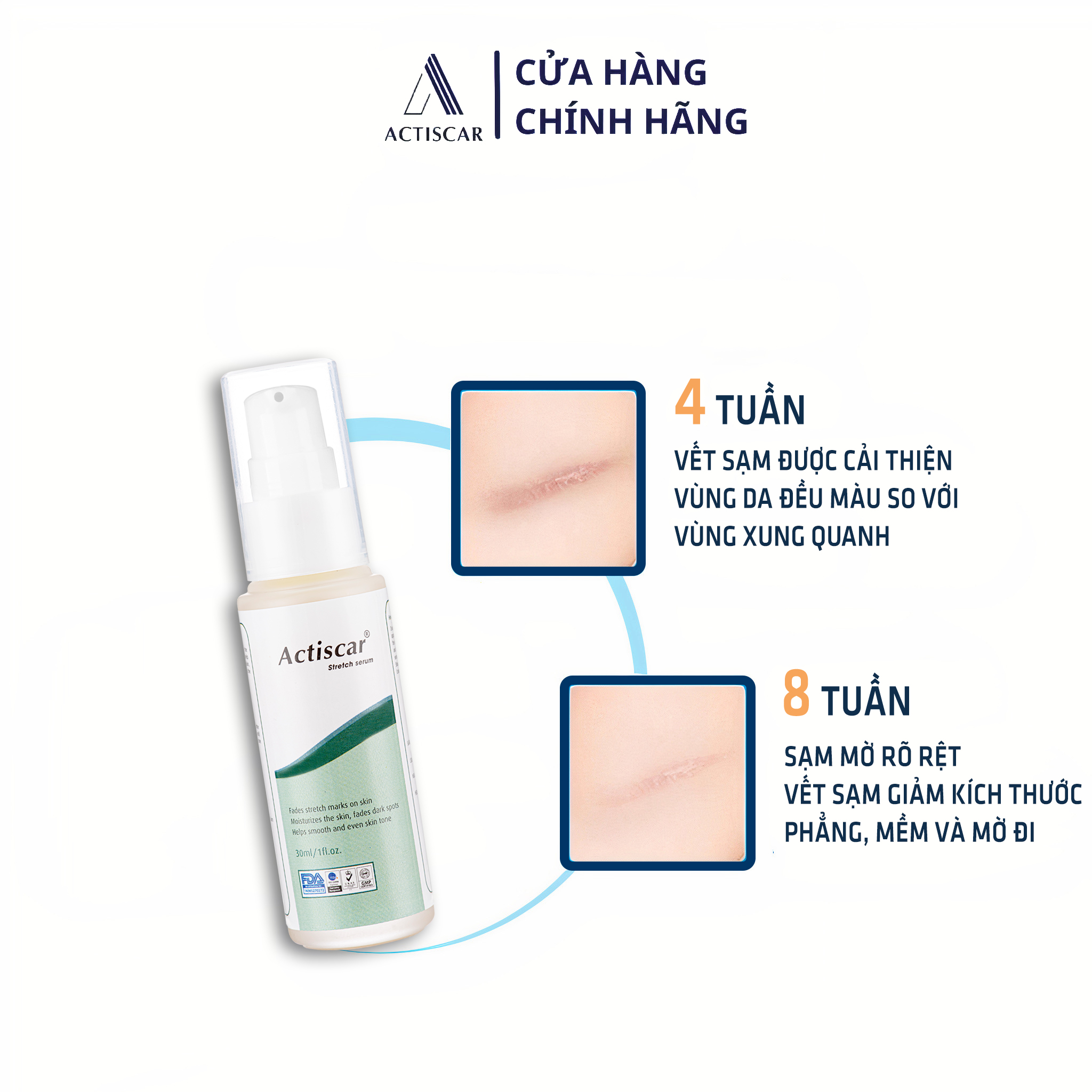 Serum Rạn Da Actiscar Làm Mờ Rạn Da, Mờ Sẹo, Đều Màu Da Sau Sinh 30ml