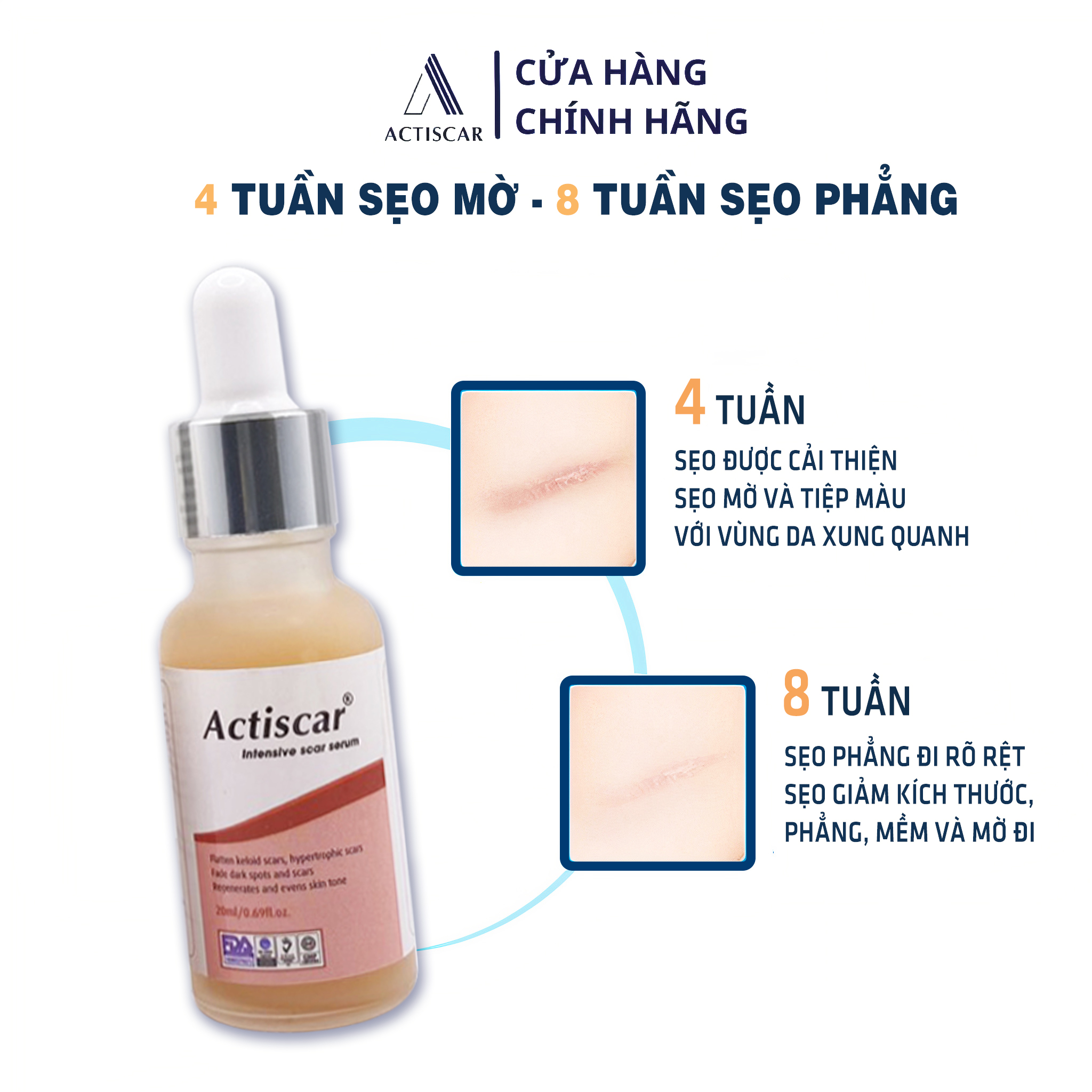 Serum Xóa Sẹo Lồi, Sẹo Phì Đại Actiscar 20ml ( Màu đỏ )