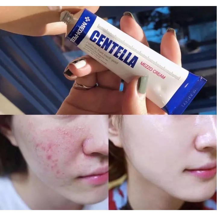 Kem Rau Má Giảm Mụn Phục Hồi Da MEDI PEEL CENTELLA MEZZO CREAM 30ML