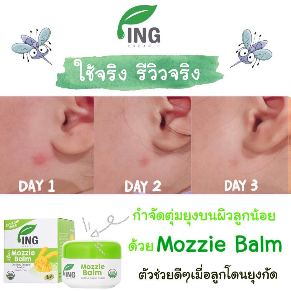 ING Organic After Balm - Kem Hữu Cơ Thoa Vết Muỗi Và Côn Trùng Đốt - Không Ngứa - Không Sưng Đỏ - Không Sẹo Thâm