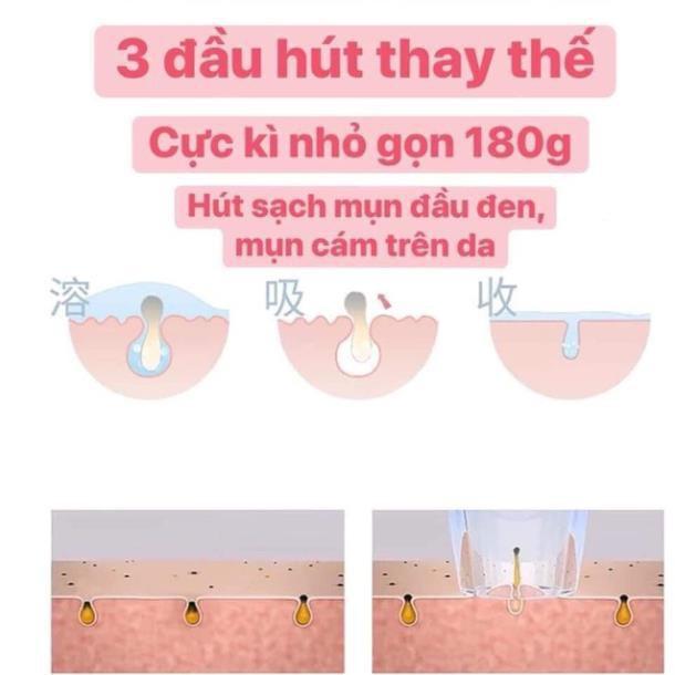 sỉ, lẻ MÁY HÚT MỤN CẦM TAY