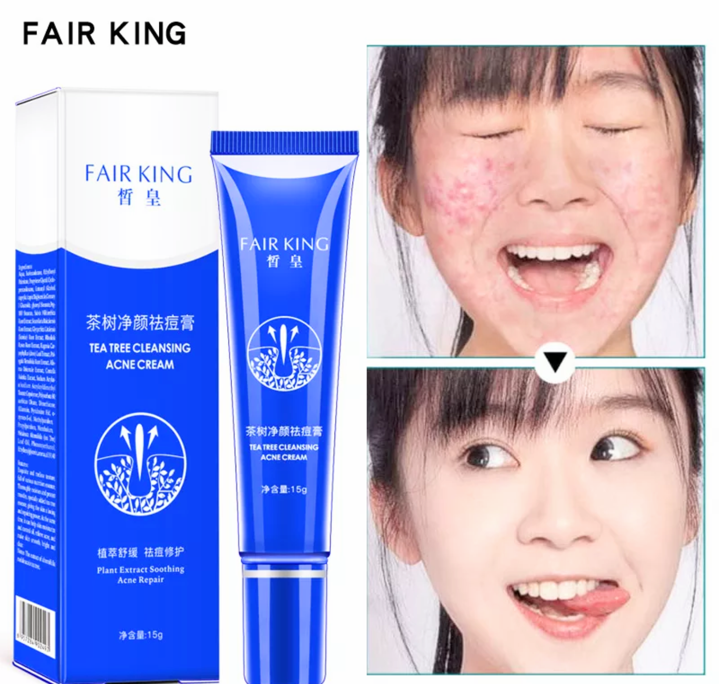 1 HỘP KEM TRỊ LOẠI BỎ MỤN LÀM MỜ CÁC VẾT SẸO TÀN NHANG DƯỠNG DA LÀM TRẮNG DA MẶT CAM KẾT HIỆU QUẢ HÀNG LOẠI TỐT
