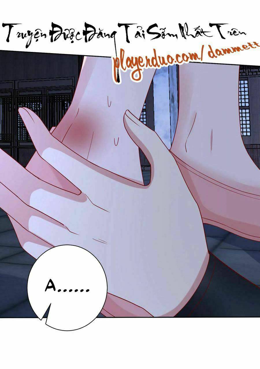 độc y đích nữ chapter 170 5