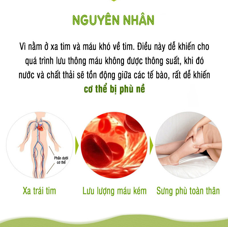 Viên uống làm thon và dài chân DHC Melilot Nhật Bản thực phẩm chức năng hỗ trợ lưu thông máu, bài tiết nước dư thừa, giảm phù nề gói 30 ngày JN-DHC-MEL30