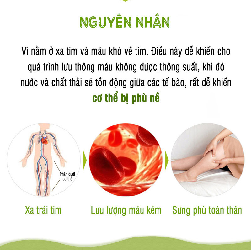 Hỗ trợ giảm các triệu chứng đau, sưng, phù nề chân do suy giãn tĩnh mạch DHC Nhật  - QuaTangMe Extaste