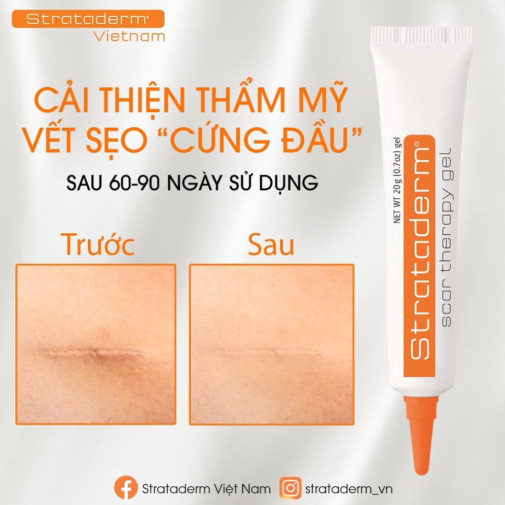 Strataderm 10g - Gel Silicone ngăn ngừa sẹo xấu