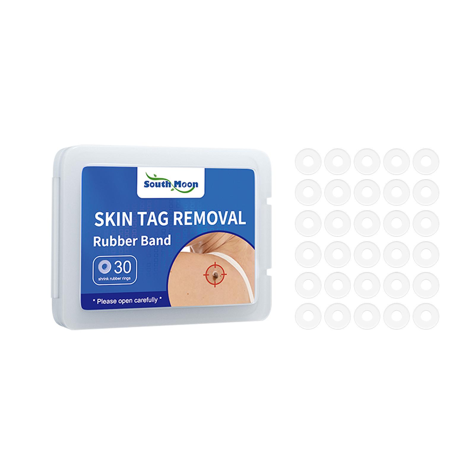 South Moon 30pcs/Box Mole Wart Remover Skin Tag Rubber Band Soften Keratin Painless Removal