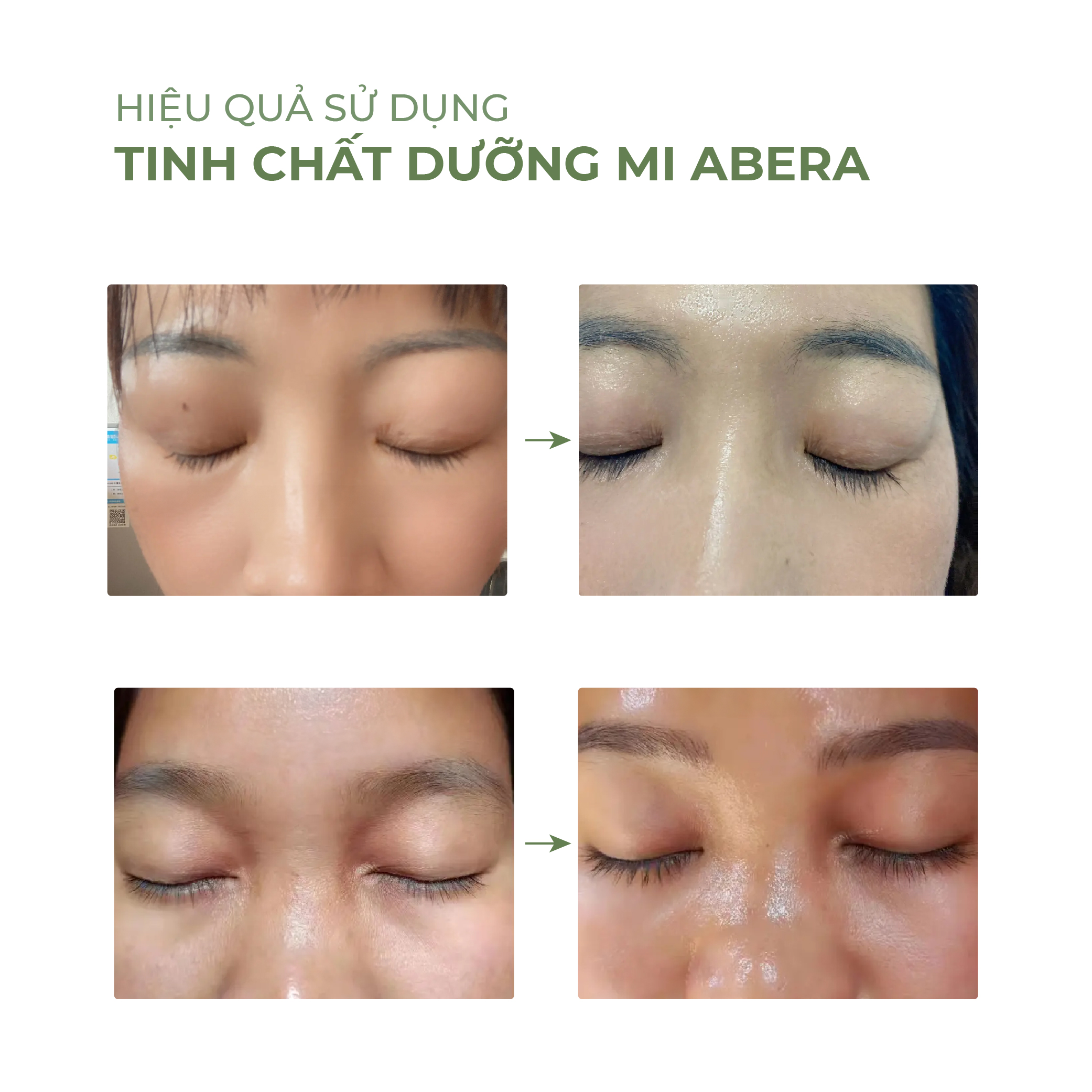 [COMBO 3] Tinh Chất Dưỡng Mi ABERA Dưỡng Mi Dài Và Dày, Cải Thiện Tình Trạng Mi Thưa, Dễ Gãy Rụng